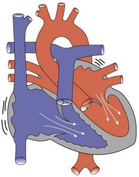 Heart contracting - atrial contractions