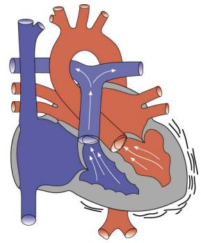 Diagram 2.3 Heart contracting - ventricular contractions